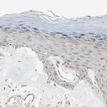 CGRRF1 Antibody in Immunohistochemistry (Paraffin) (IHC (P))