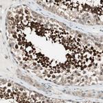 CGRRF1 Antibody in Immunohistochemistry (Paraffin) (IHC (P))