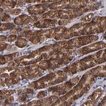 TIMM9 Antibody in Immunohistochemistry (Paraffin) (IHC (P))