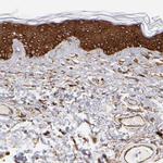 AHNAK2 Antibody in Immunohistochemistry (Paraffin) (IHC (P))