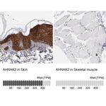 AHNAK2 Antibody in Immunohistochemistry (IHC)