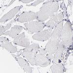 AHNAK2 Antibody in Immunohistochemistry (IHC)