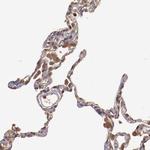 SRRD Antibody in Immunohistochemistry (IHC)