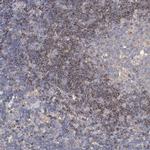 SRRD Antibody in Immunohistochemistry (IHC)