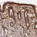 SRRD Antibody in Immunohistochemistry (IHC)