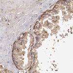 SRRD Antibody in Immunohistochemistry (IHC)