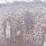 HCCS Antibody in Immunohistochemistry (Paraffin) (IHC (P))