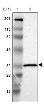 HCCS Antibody in Western Blot (WB)