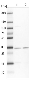 HCCS Antibody in Western Blot (WB)