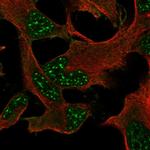 DRP2 Polyclonal Antibody