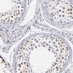 TEX11 Polyclonal Antibody