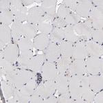 GMFB Antibody in Immunohistochemistry (Paraffin) (IHC (P))