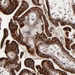 ELP2 Antibody in Immunohistochemistry (IHC)