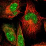 C6orf211 Polyclonal Antibody