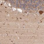 DLST Antibody in Immunohistochemistry (Paraffin) (IHC (P))