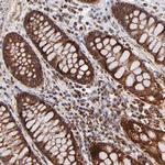 DLST Polyclonal Antibody