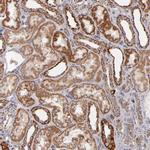 DLST Antibody in Immunohistochemistry (Paraffin) (IHC (P))