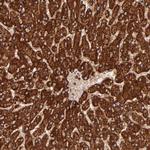 DLST Antibody in Immunohistochemistry (Paraffin) (IHC (P))