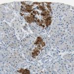 ASB9 Polyclonal Antibody