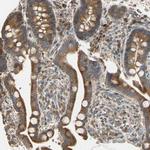 STX18 Antibody in Immunohistochemistry (Paraffin) (IHC (P))
