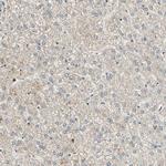 RBM25 Antibody in Immunohistochemistry (Paraffin) (IHC (P))