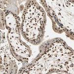 RBM25 Antibody in Immunohistochemistry (Paraffin) (IHC (P))