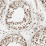 RBM25 Antibody in Immunohistochemistry (Paraffin) (IHC (P))