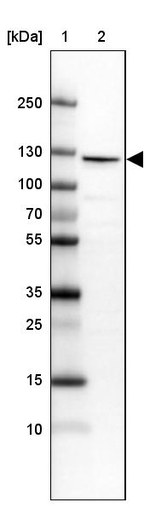 RBM25 Antibody in Western Blot (WB)