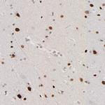 ZFP92 Antibody in Immunohistochemistry (Paraffin) (IHC (P))