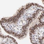 ZFP92 Antibody in Immunohistochemistry (Paraffin) (IHC (P))