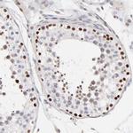 ZFP92 Antibody in Immunohistochemistry (Paraffin) (IHC (P))