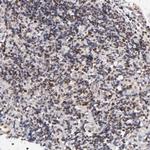 ZFP92 Polyclonal Antibody