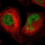 SAGE1 Antibody in Immunocytochemistry (ICC/IF)
