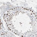 SAGE1 Antibody in Immunohistochemistry (Paraffin) (IHC (P))