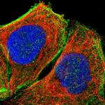 DHRSX Polyclonal Antibody