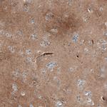 DHRSX Antibody in Immunohistochemistry (Paraffin) (IHC (P))