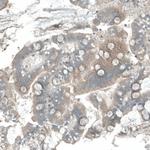DHRSX Antibody in Immunohistochemistry (Paraffin) (IHC (P))
