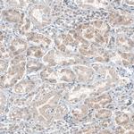 DHRSX Antibody in Immunohistochemistry (Paraffin) (IHC (P))