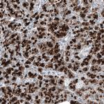 DHRSX Antibody in Immunohistochemistry (Paraffin) (IHC (P))