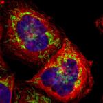 TOMM22 Polyclonal Antibody