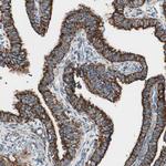 TOMM22 Antibody in Immunohistochemistry (IHC)