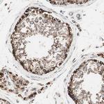 TOMM22 Antibody in Immunohistochemistry (IHC)