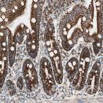 TOMM22 Antibody in Immunohistochemistry (IHC)