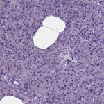 MLC1 Antibody in Immunohistochemistry (Paraffin) (IHC (P))