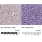 MLC1 Antibody in Immunohistochemistry (IHC)