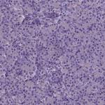 MLC1 Antibody in Immunohistochemistry (IHC)