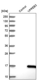 VPREB3 Antibody in Western Blot (WB)