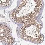 TTLL12 Antibody in Immunohistochemistry (IHC)