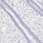 ASB9 Antibody in Immunohistochemistry (IHC)