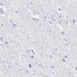 ASB9 Antibody in Immunohistochemistry (IHC)